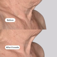 Load image into Gallery viewer, The Elevator Neck/Décolleté Concentrate - Refill