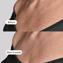 Load image into Gallery viewer, The Elevator Neck/Décolleté Concentrate - Refill